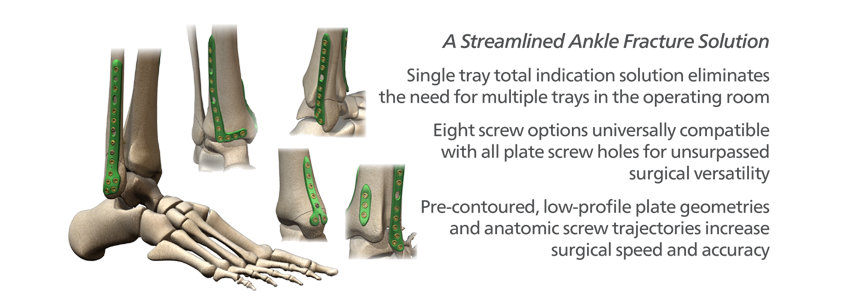 ORTHOLOC™ Ankle Fracture Plating System
